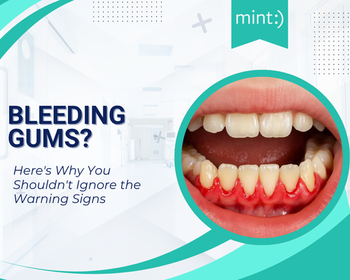 Bleeding Gums? Here's Why You Shouldn't Ignore the Warning Signs
