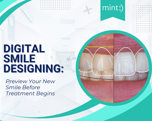 Digital Smile Designing: Preview Your New Smile Before Treatment Begins