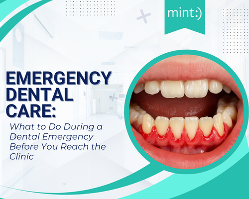 Emergency Dental Care: What to Do During a Dental Emergency Before You Reach the Clinic