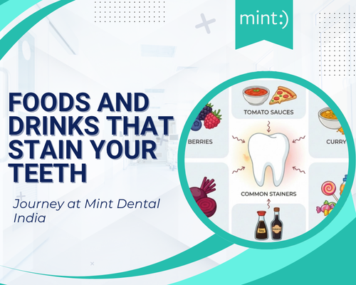 Foods and Drinks That Stain Your Teeth