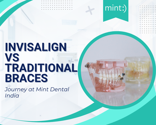Invisalign clear aligners vs traditional braces