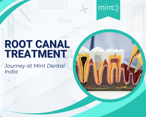 Is Root Canal Treatment Painful? Modern Myths vs Reality