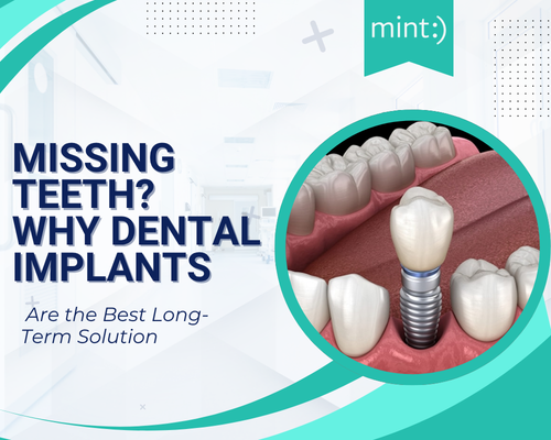 Missing Teeth? Why Dental Implants Are the Best Long-Term Solution