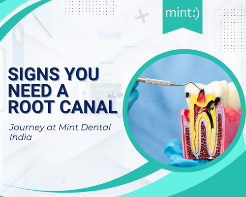 Signs You Need a Root Canal Before It Becomes an Emergency