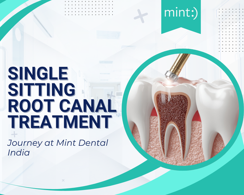Single Sitting Root Canal Treatment: Benefits, Process & Recovery