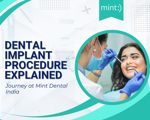 Step-by-Step Dental Implant Procedure Explained for First-Time Patients