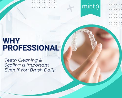 Why Professional Teeth Cleaning & Scaling Is Important Even If You Brush Daily
